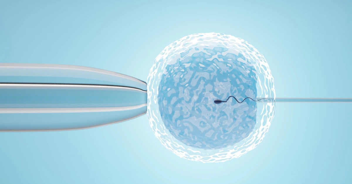 IVF – In Vitro Fertilization