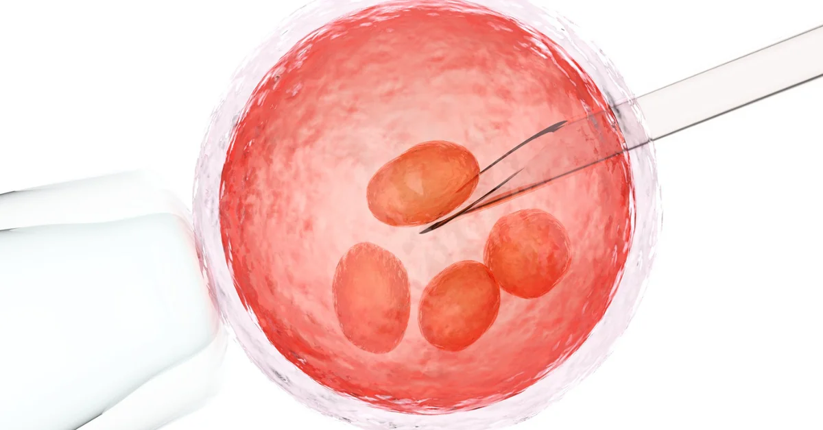 Egg Donation