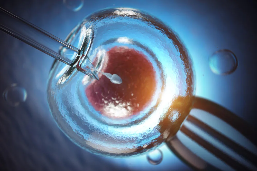 IVF – In Vitro Fertilization