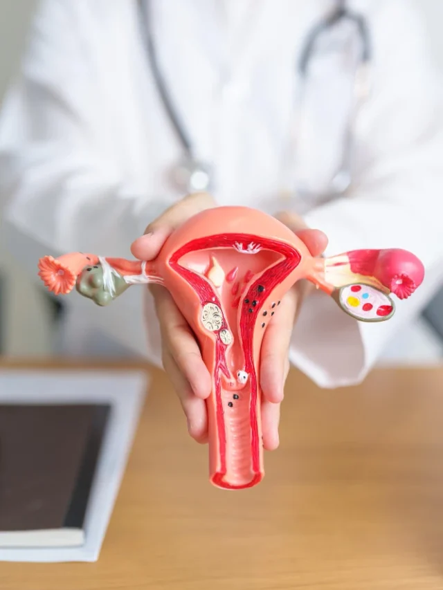 How to Manage PCOS Naturally