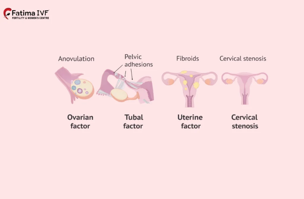Causes of Female Infertility