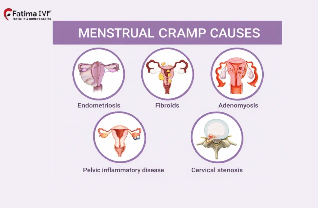 Causes of Menstrual Cramps