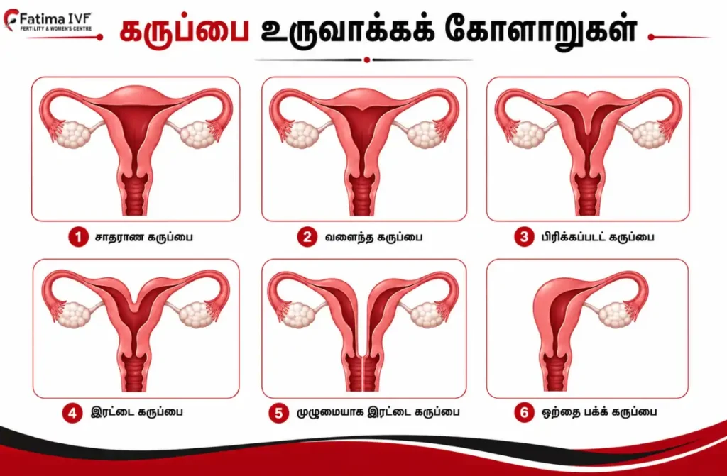 கருப்பை நார்த்திசு சிகிச்சை